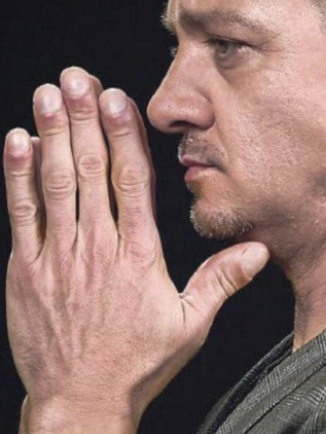 jeremy renner fingers condition