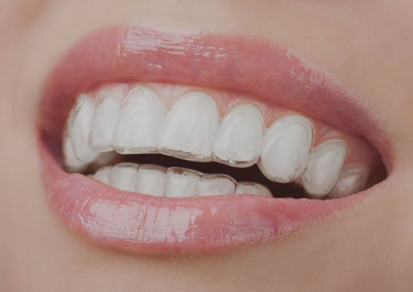 invisalign stamford ct