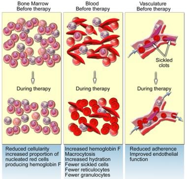 breakthrough in treatment of sca type 6