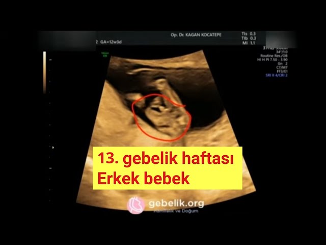 12 haftalık erkek bebek görüntüsü