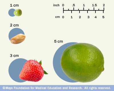 4.2 cm inches