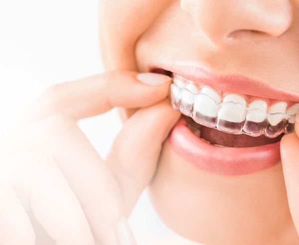 www invisalign doctor site