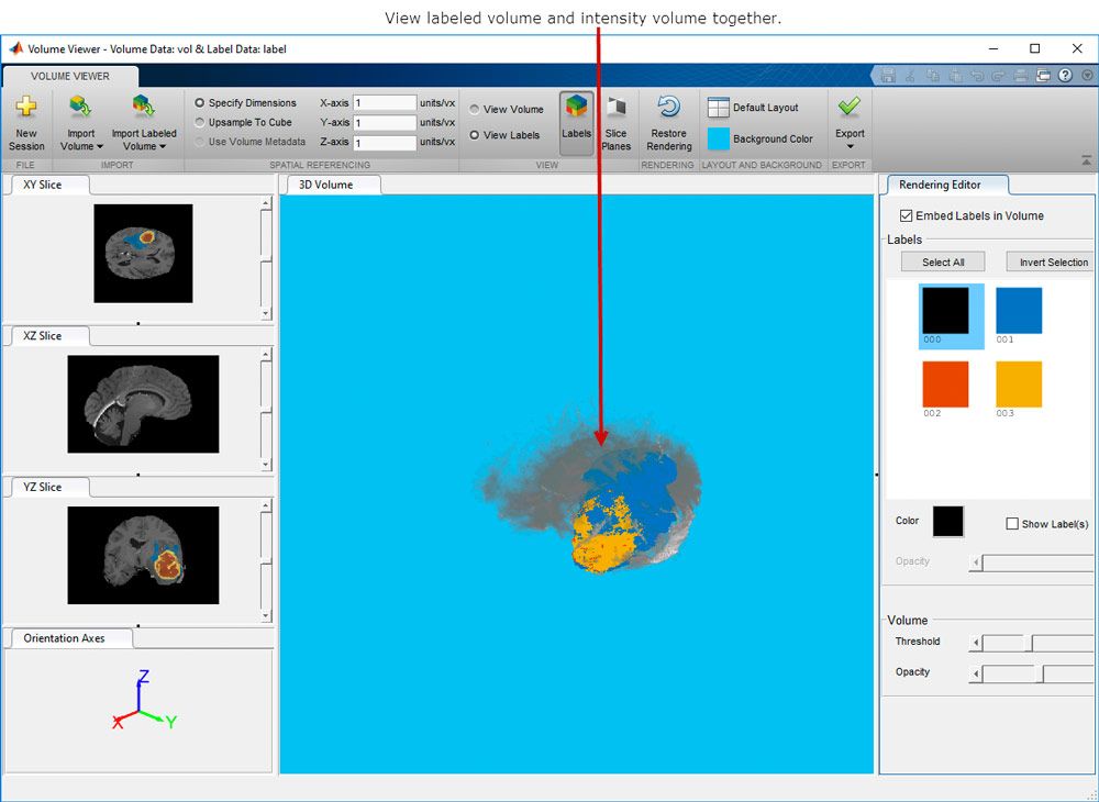 imaging matlab