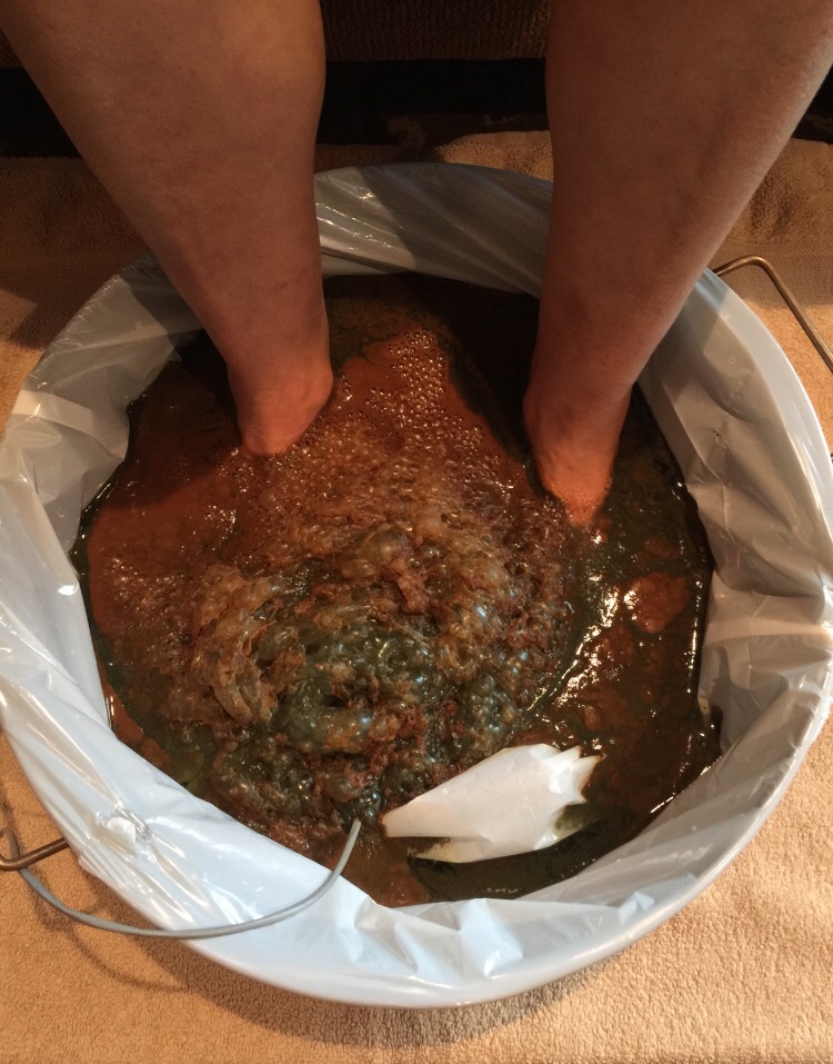 ionized foot detox near me