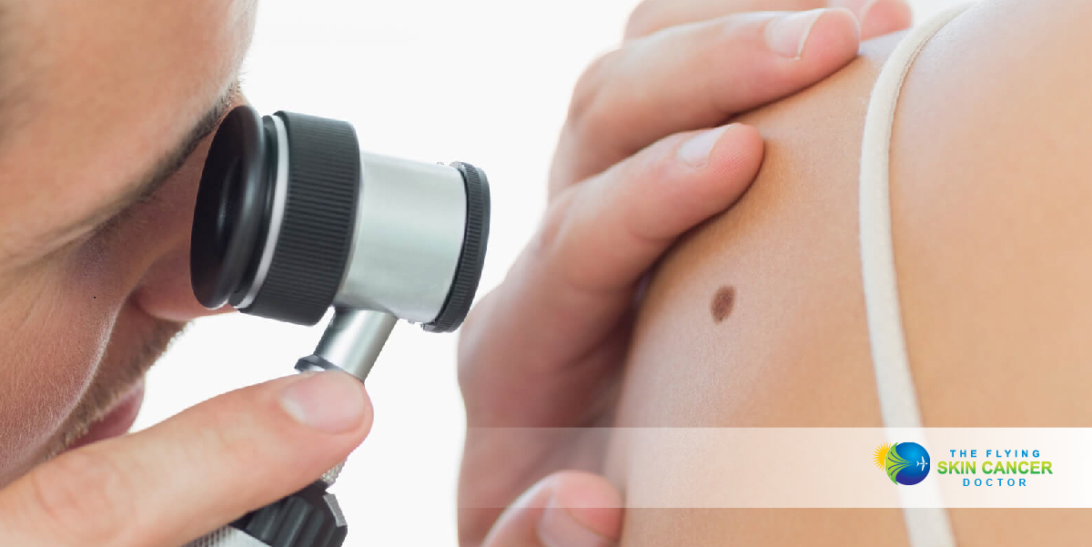 skin cancer clinic kenmore