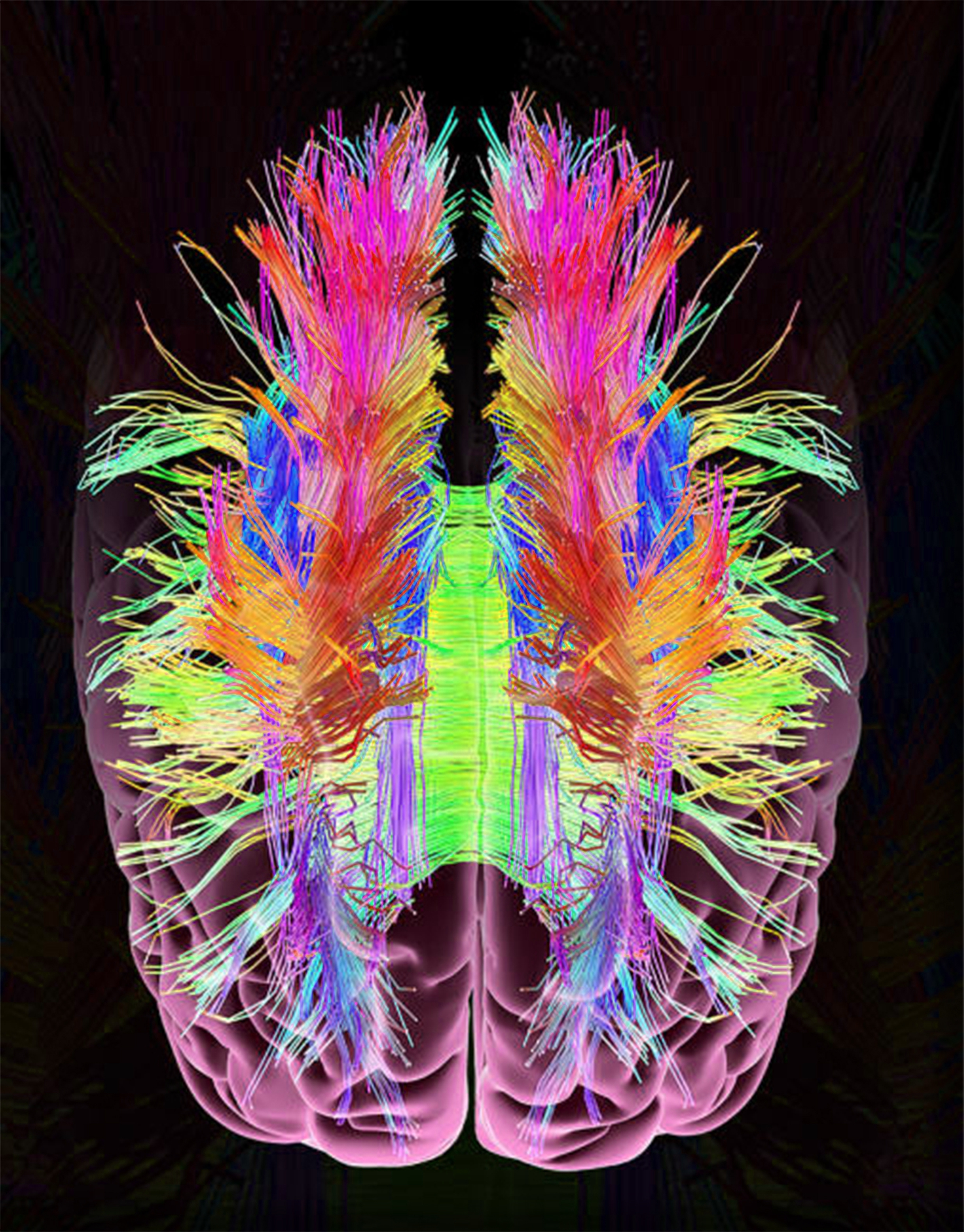 diffusion tensor imaging