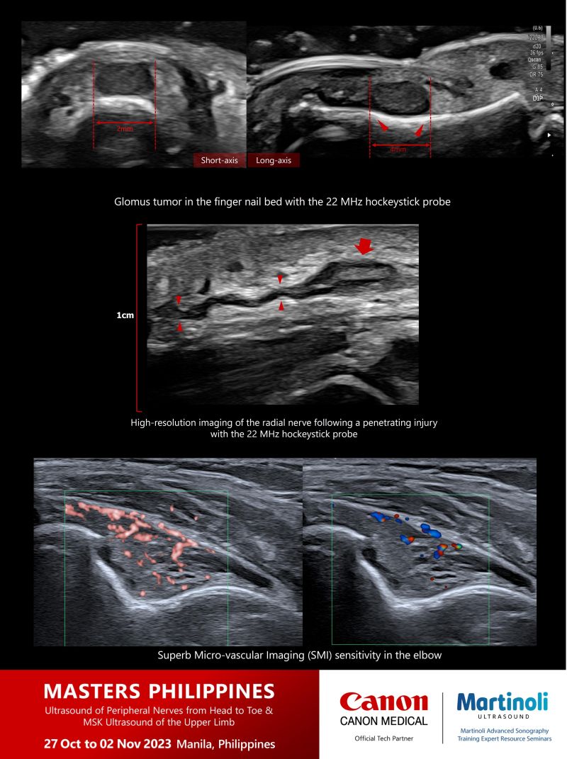 stephen bird ultrasound