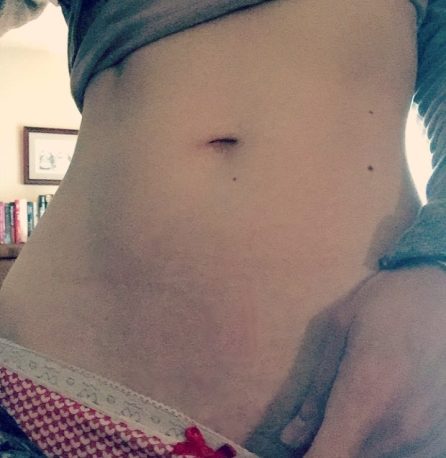 belly button fetish