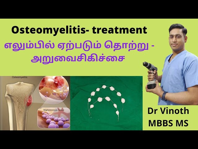 osteomyelitis meaning in tamil