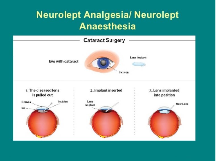 neurolept