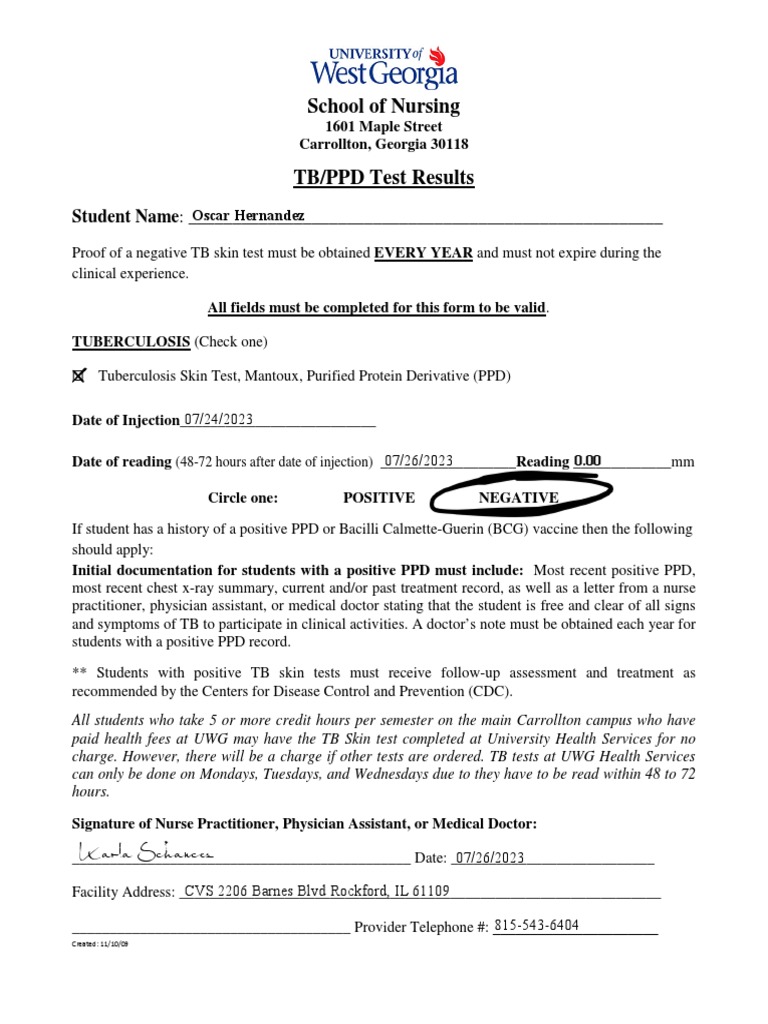 cvs tuberculosis test