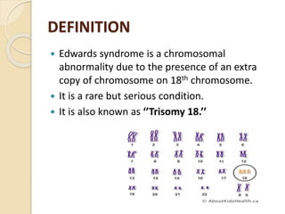 edward syndrome ppt