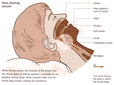 from snoring to whoring