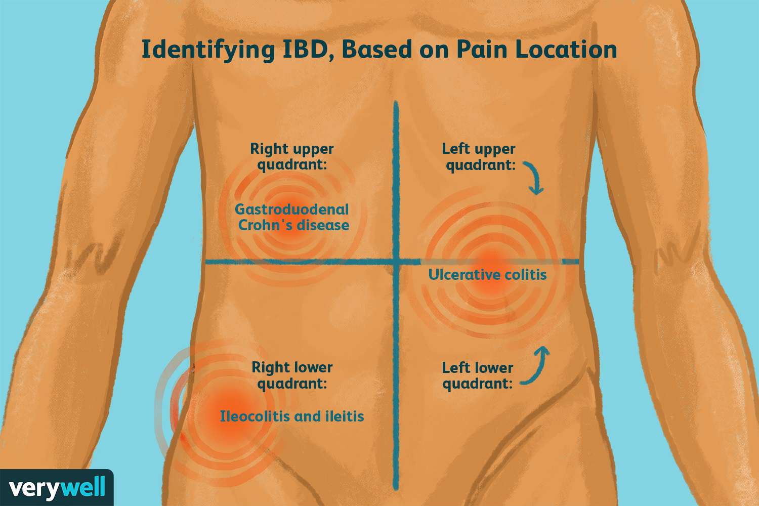 ache below ribs right side