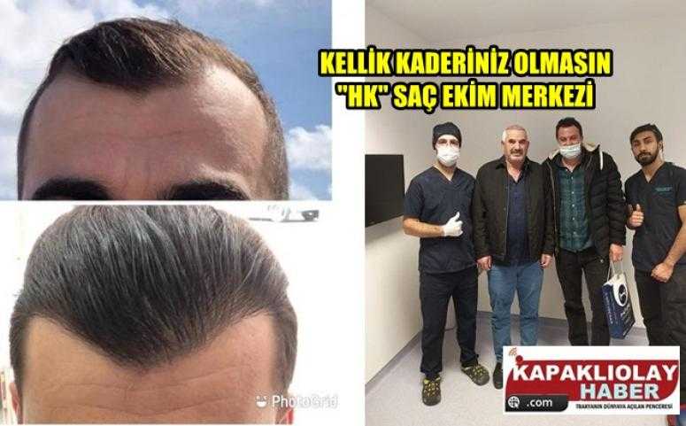 bağcılar medicine saç ekim merkezi