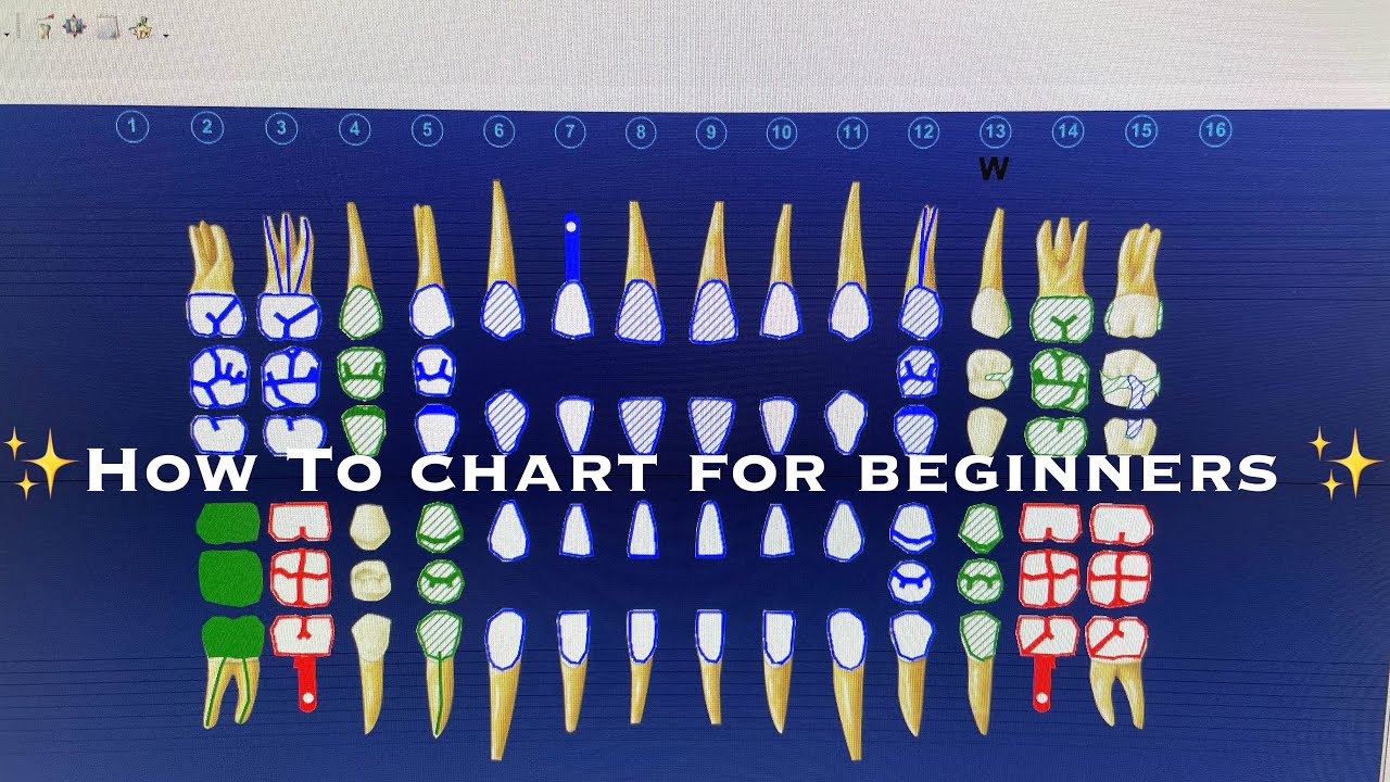 dental charting for beginners
