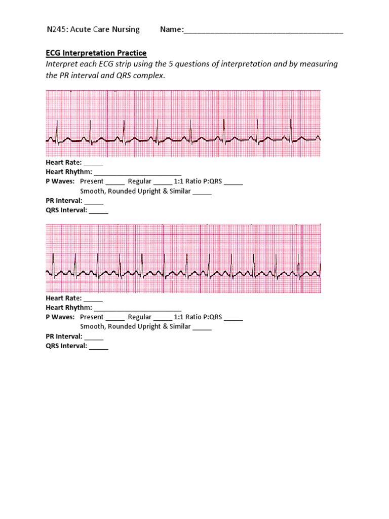 ecg drills