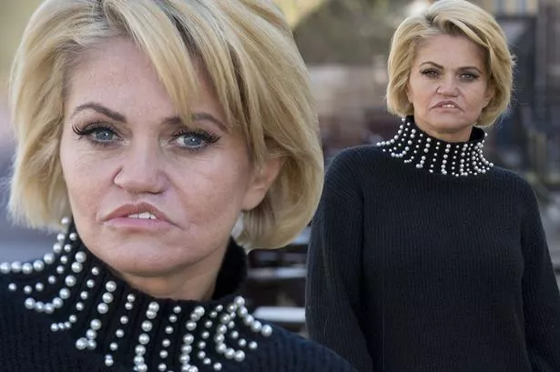 daniella westbrook face