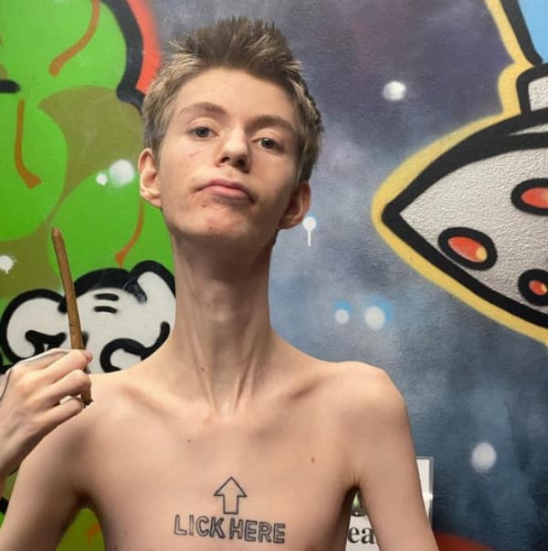 daddy long neck disease