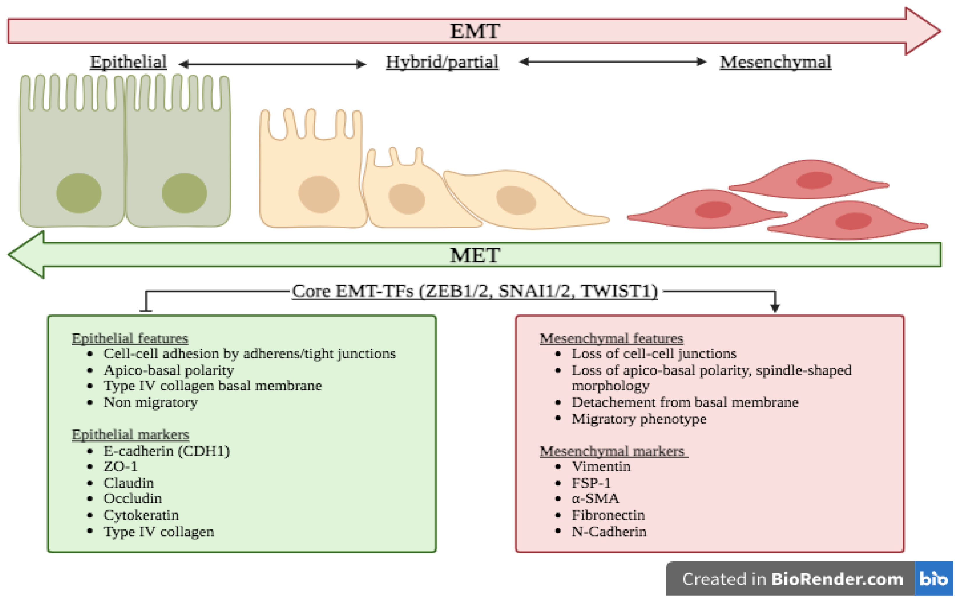 emt epithelial mesenchymal transition