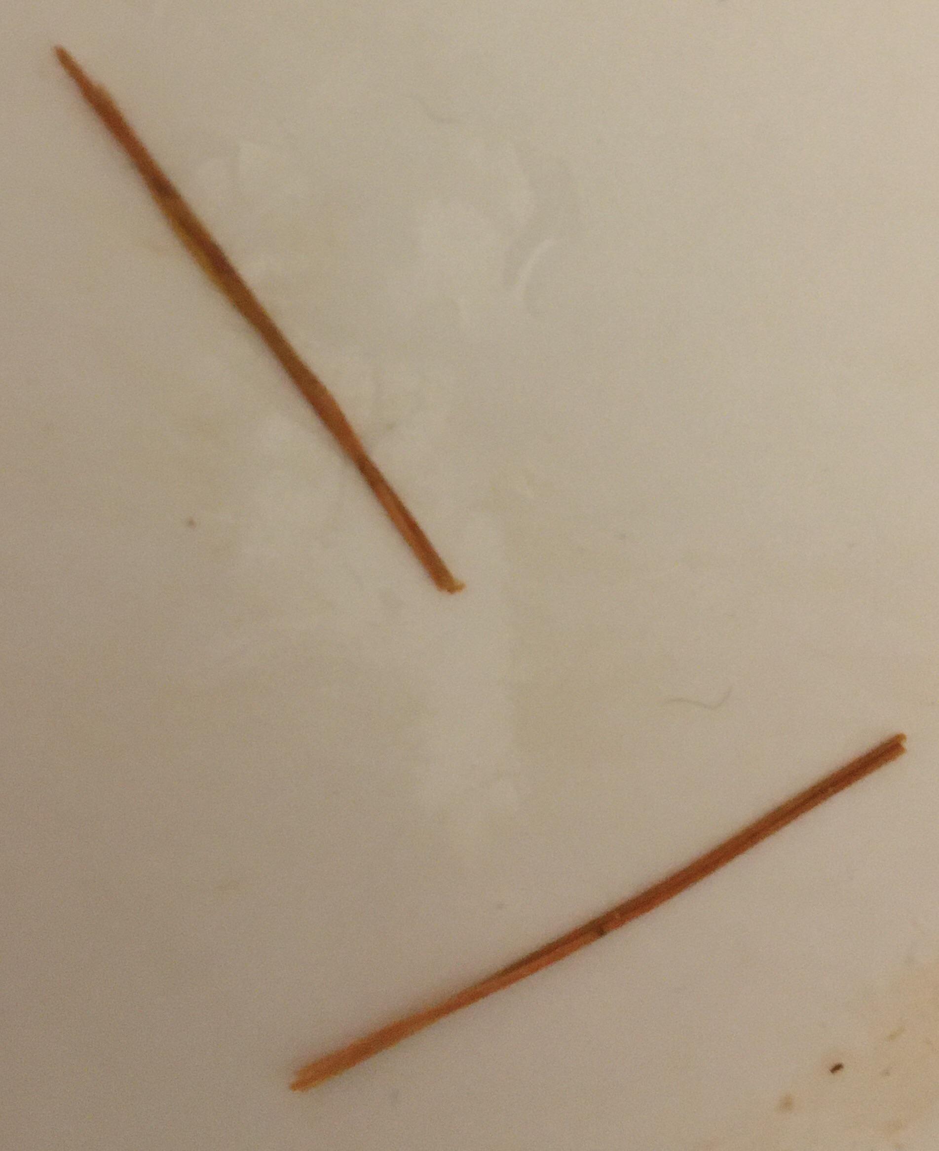 fiber strings in poop pictures