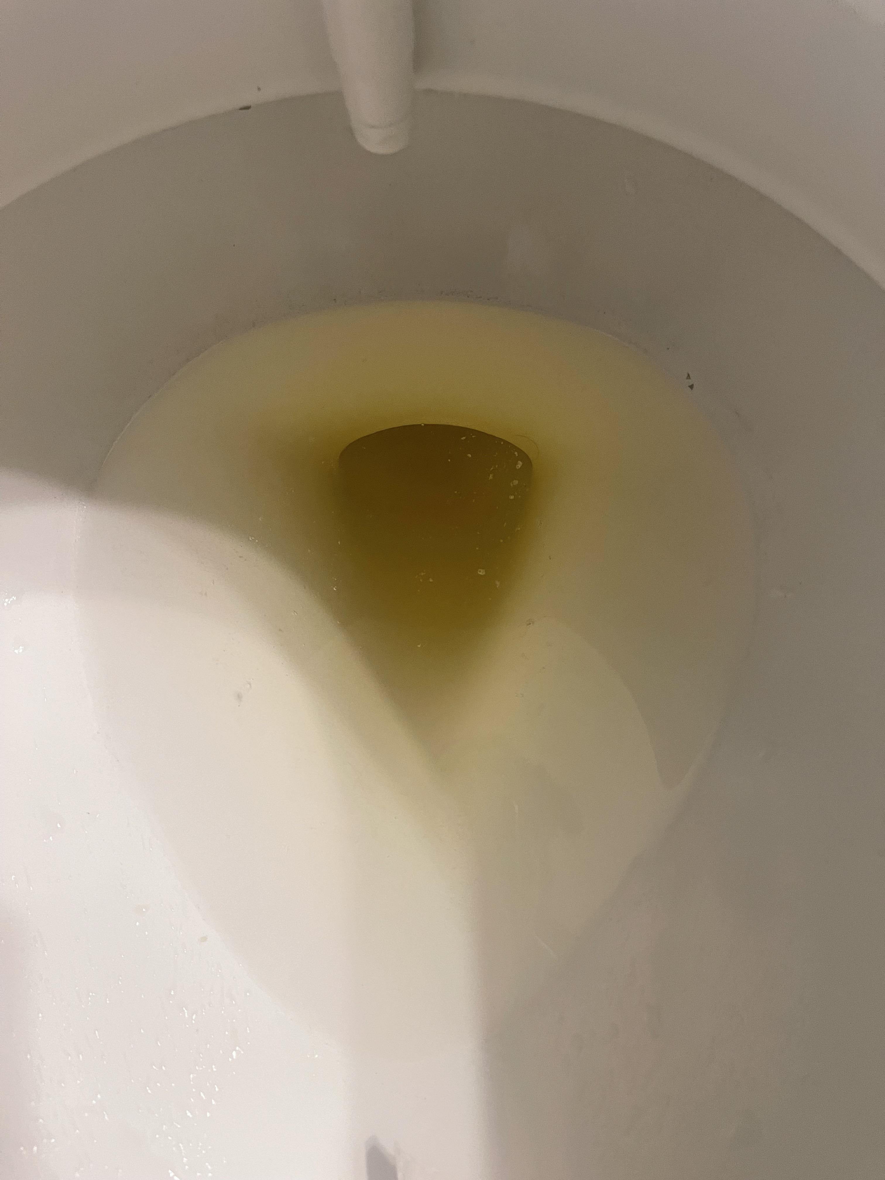 floaters in pee