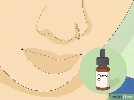 how to heal infected nose ring