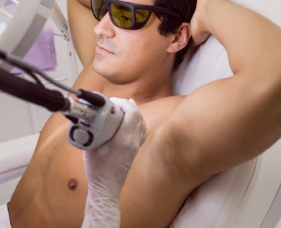 laser hair removal airdrie