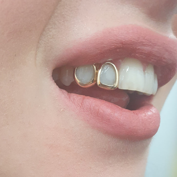 single tooth grill