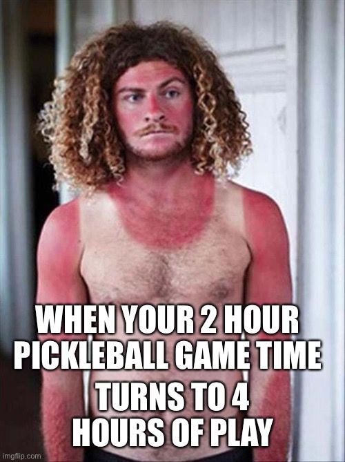 sunburn memes funny