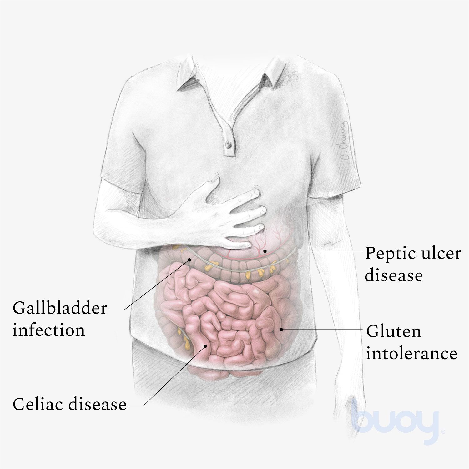 upper abdomen muscle spasm