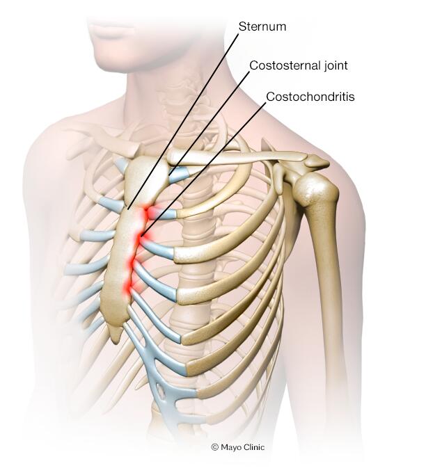 upper right side of ribs pain